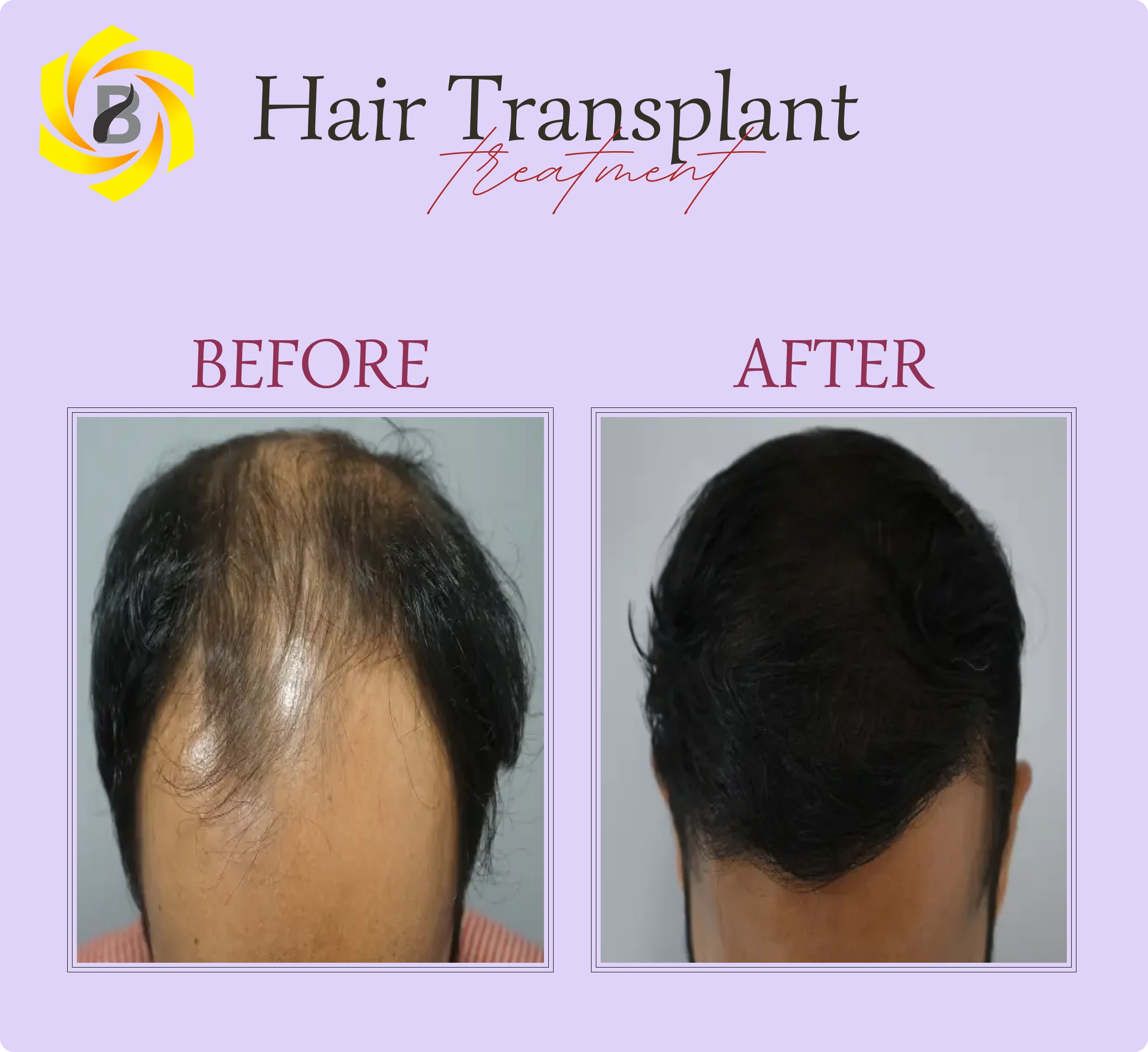 Before & After Result 6