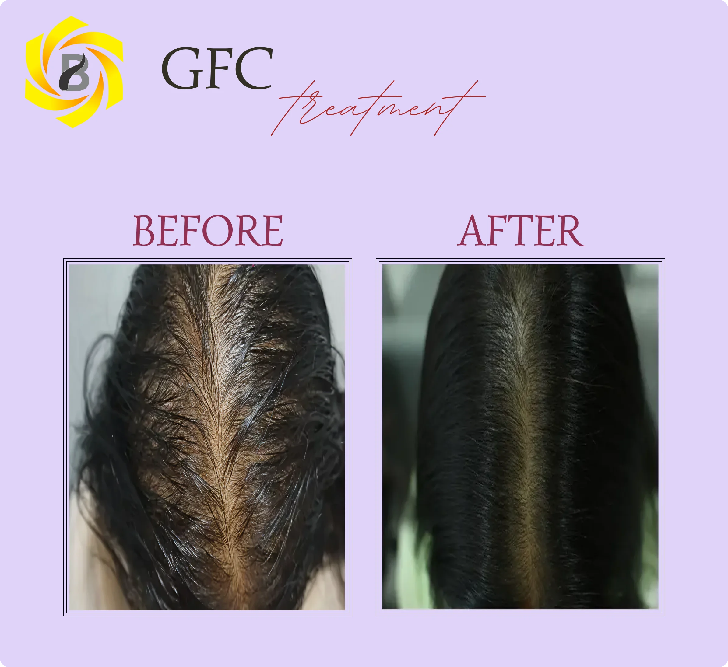 Before & After Result 6