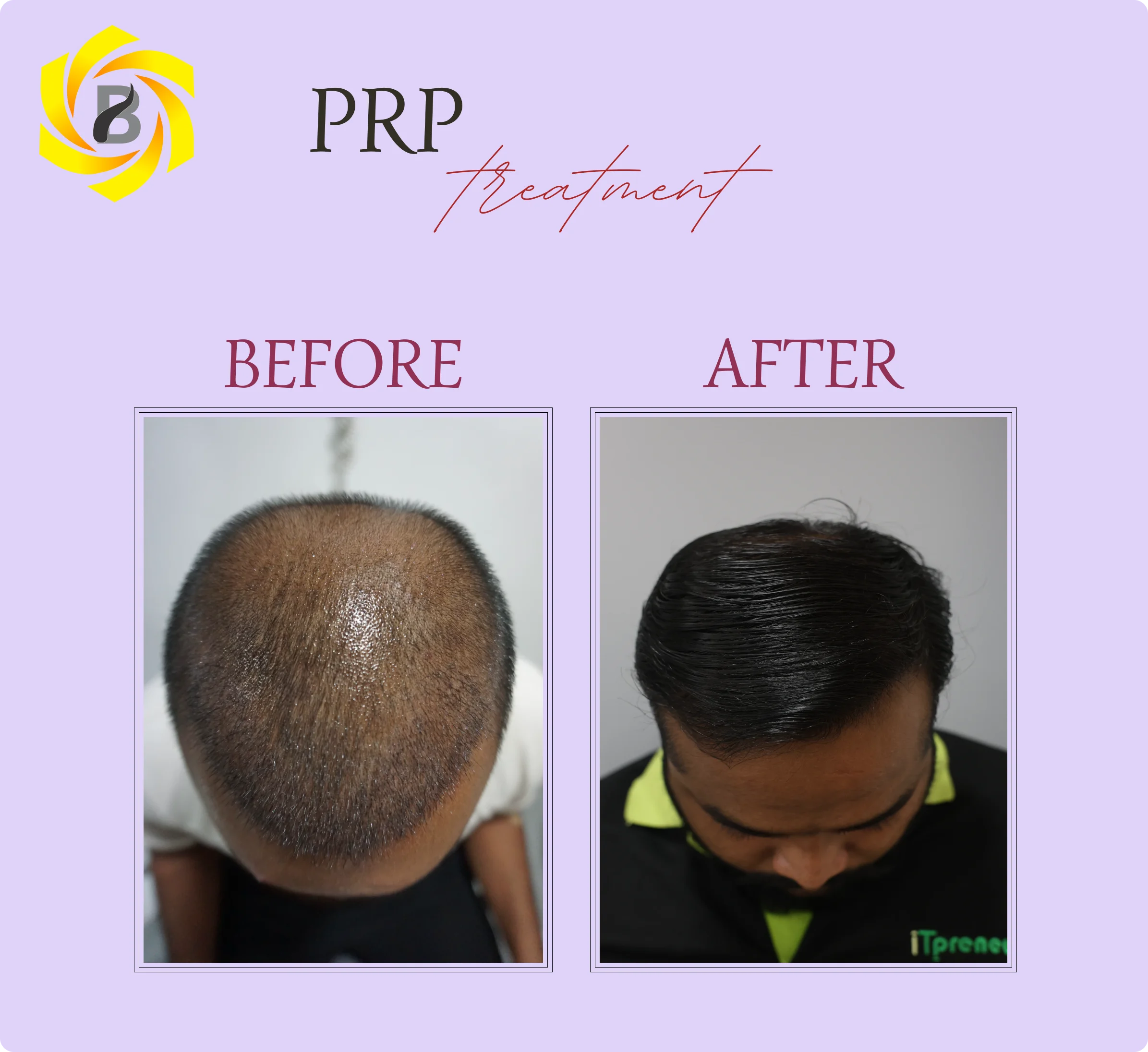 Before & After Result 7