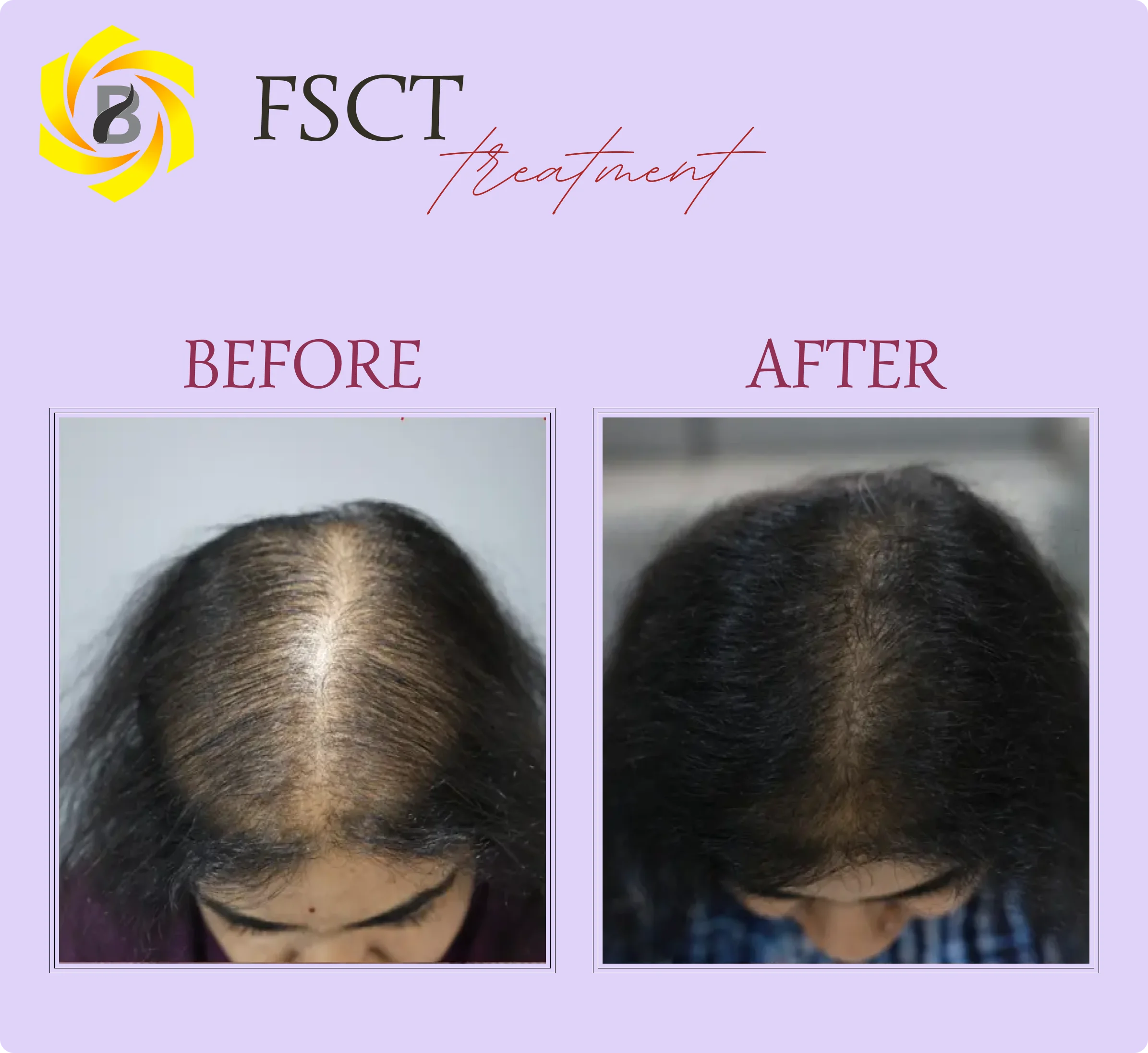 Before & After Result 7