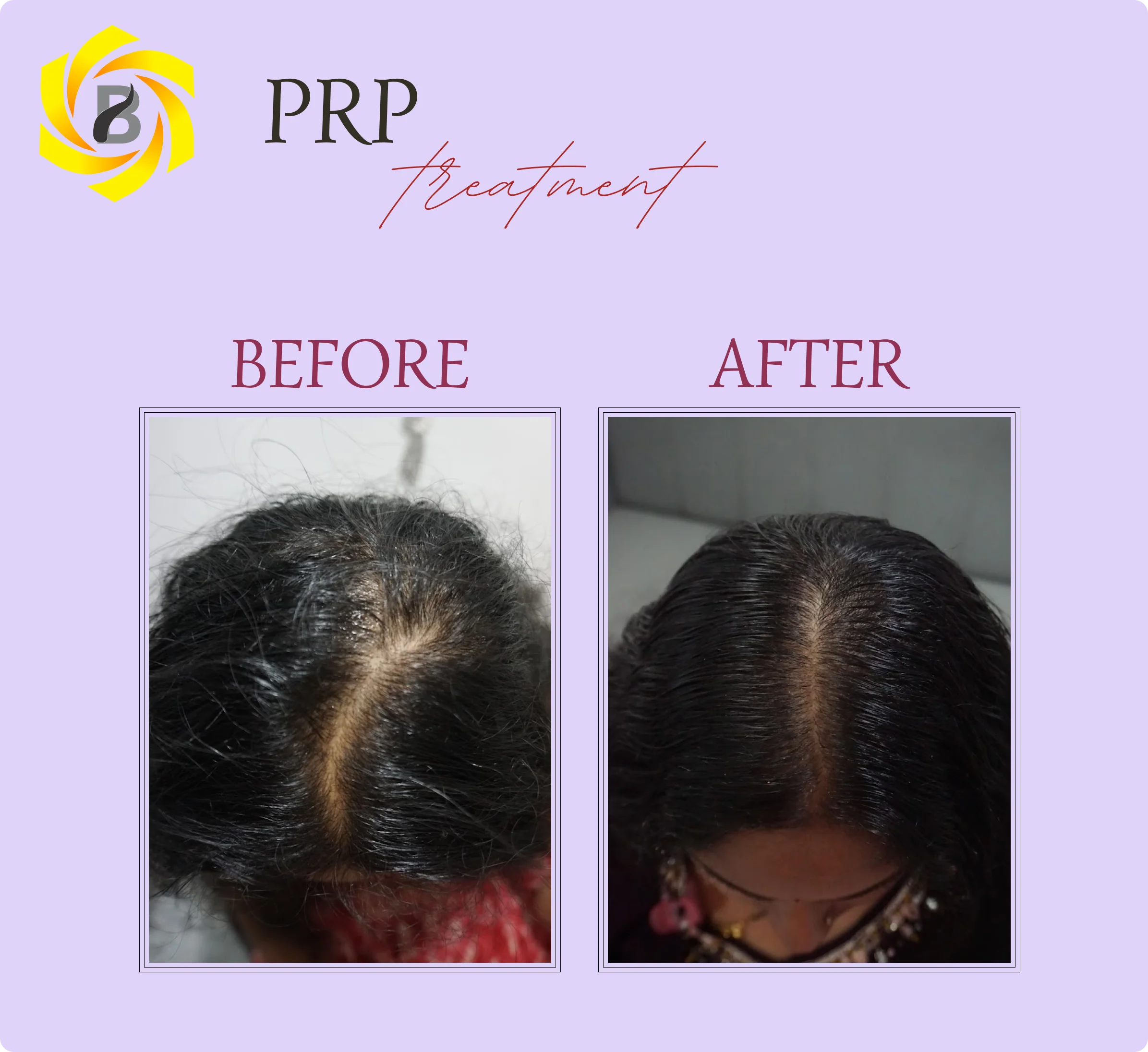 Before & After Result 8