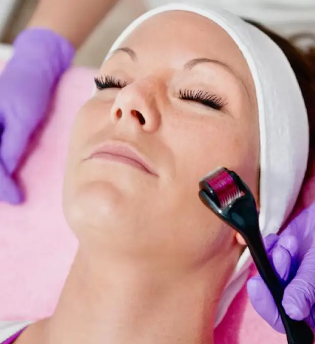Dermaroller Treatment