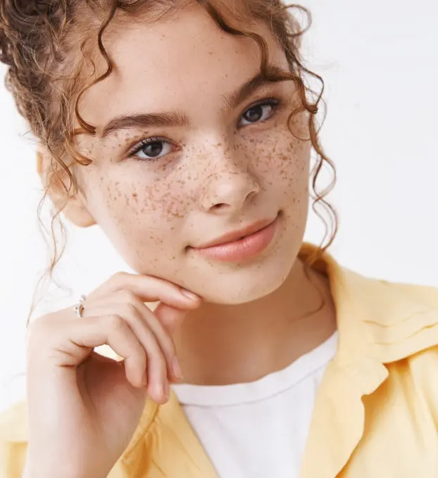 Freckles Treatment