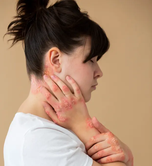 Fungal Infection Treatment