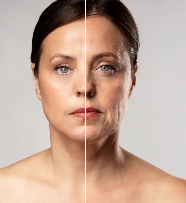 HIFU Treatment