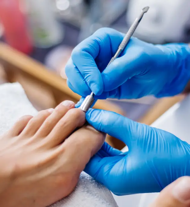 Nail Peeling Treatment