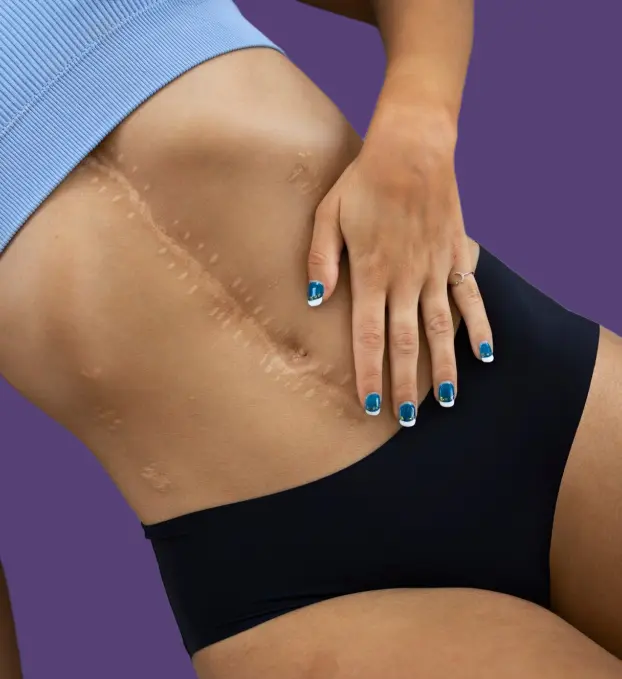 Scar Revision Surgery